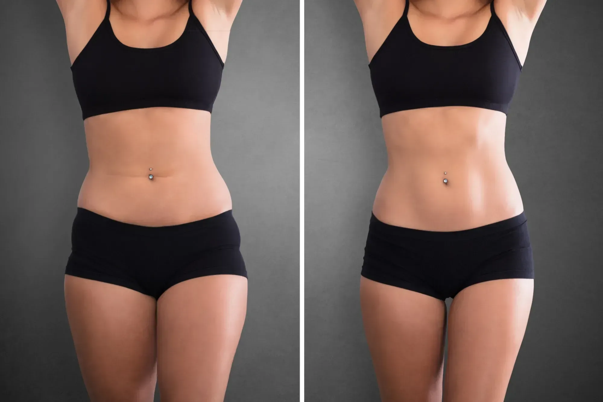 Medical Weight Loss before and after