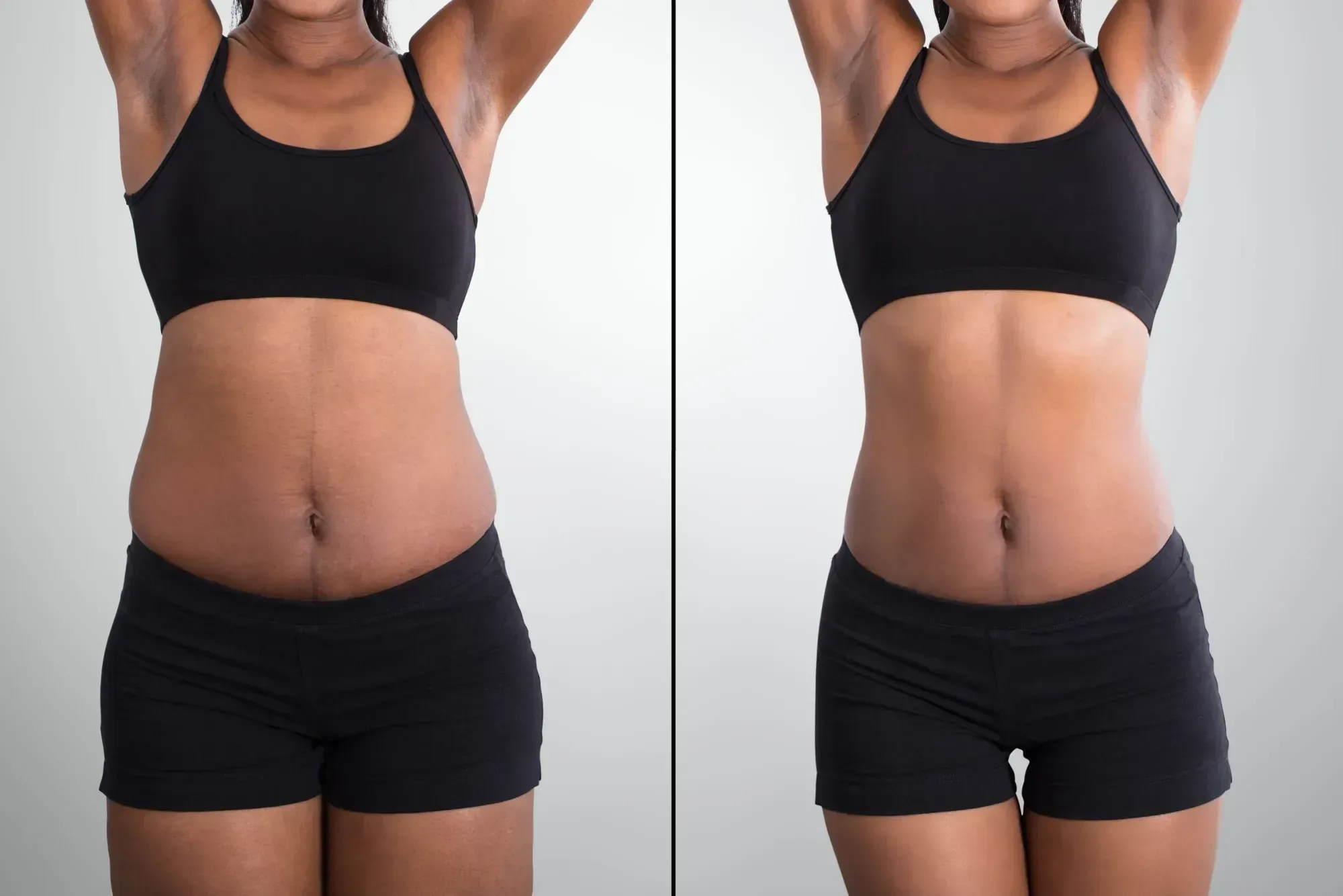 Medical Weight Loss before and after