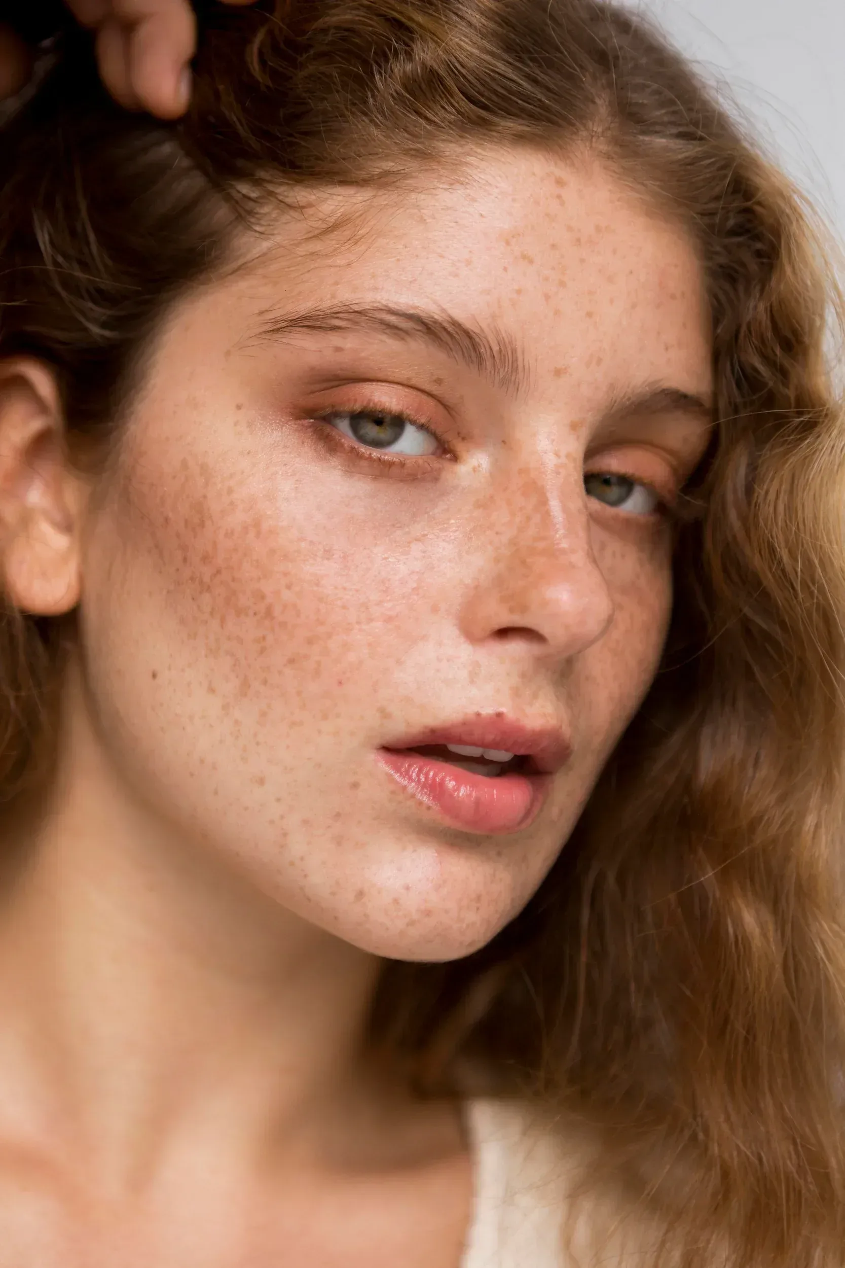 Close-up of uneven brown pigmentation along the cheekbone of a patient in Lake Havasu City, Arizona
