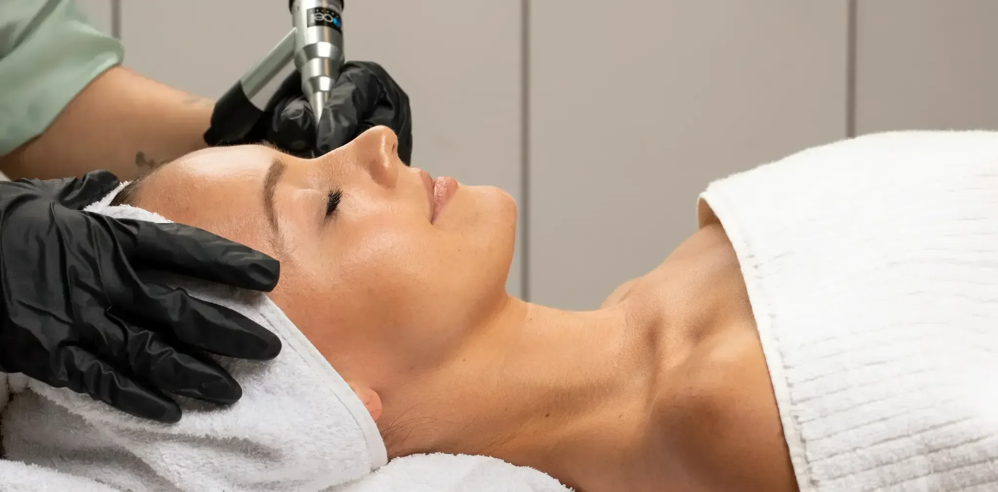 Procell microchanneling treatment in progress at Desert Oasis Wellness and Med Spa in Lake Havasu City, AZ