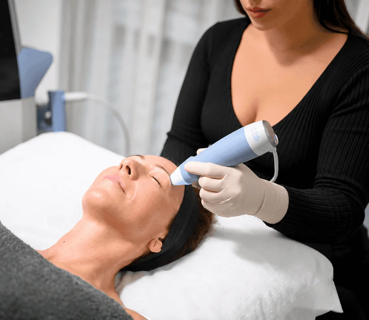 Before and after comparison showing firmer smoother skin following RF microneedling in Lake Havasu City
