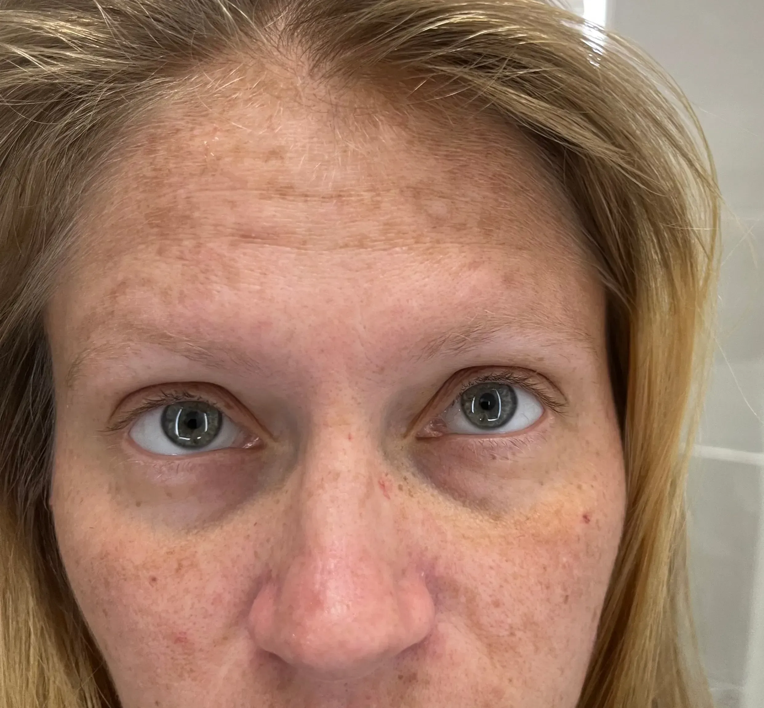 Bright laser and skin treatment room at Desert Oasis Wellness and Med Spa in Lake Havasu City Arizona